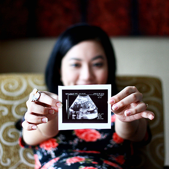 How-Pregnancy-Can-Affect-Oral-Health-2017_543