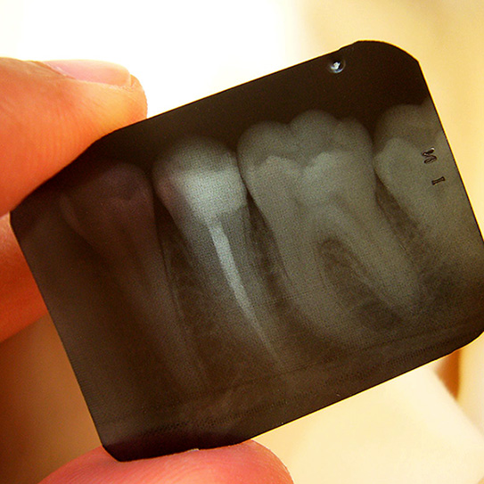 DentalXrays_543