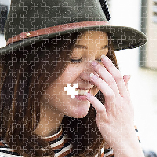 congenitally-missing-teeth_543