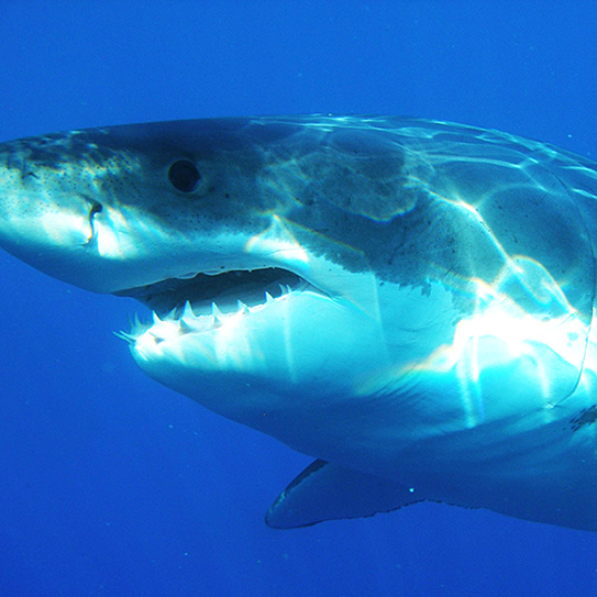 supernumerary-teeth_543