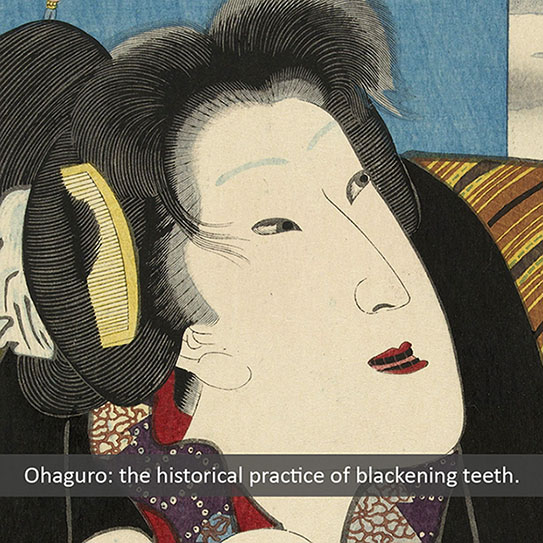 historical teeth traditions 2021 543 Michael Kim, DDS