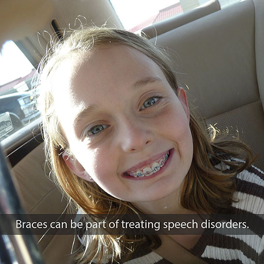 braces speech 2021 543 Abari Orthodontics and Oral Surgery -